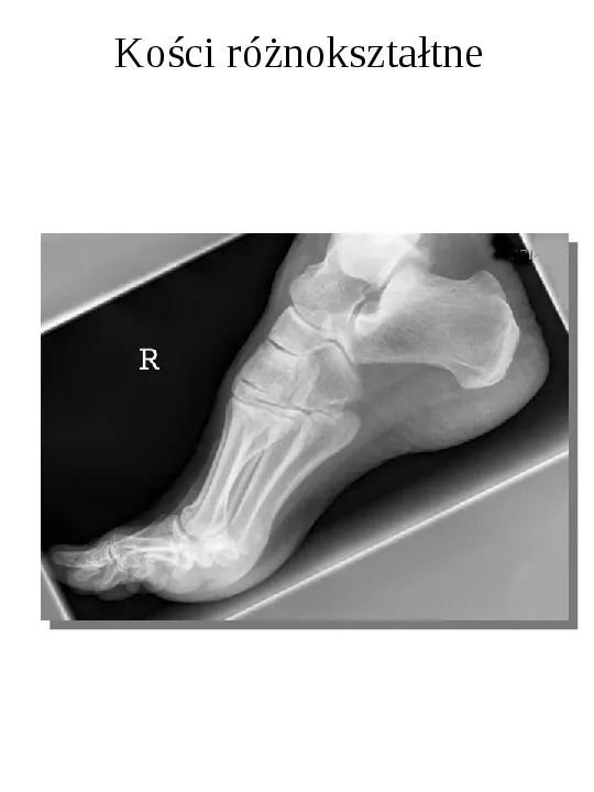 Osteologia - Slide 14