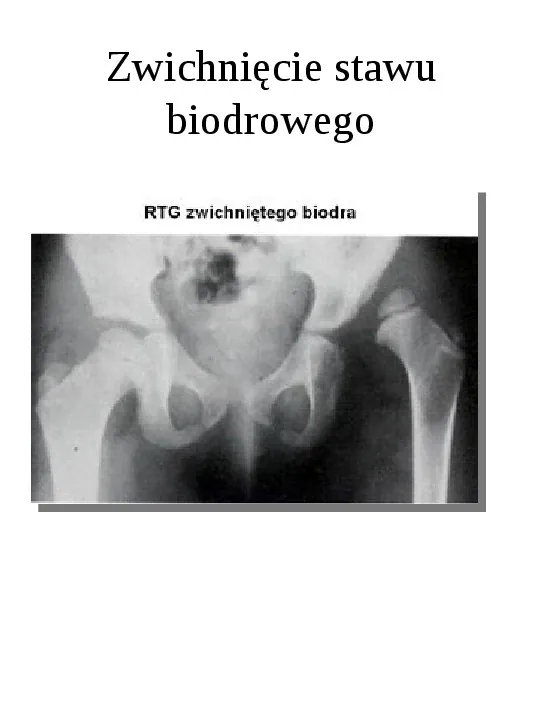 Osteologia - Slide 33