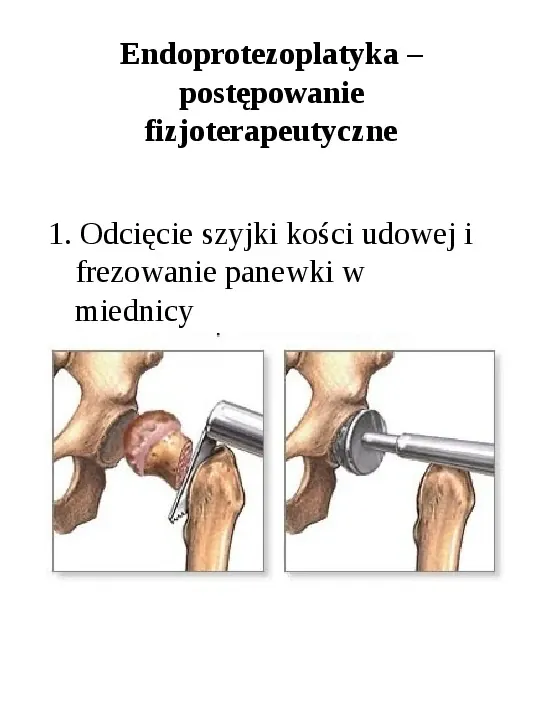 Osteologia - Slide 38