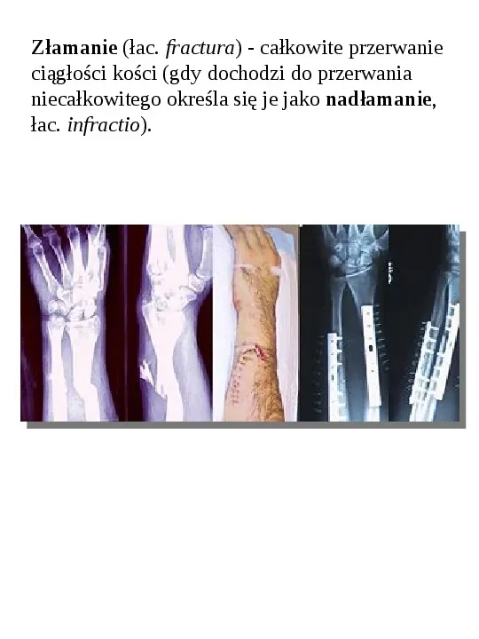Osteologia - Slide 41