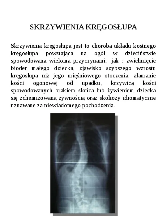 Osteologia - Slide 59