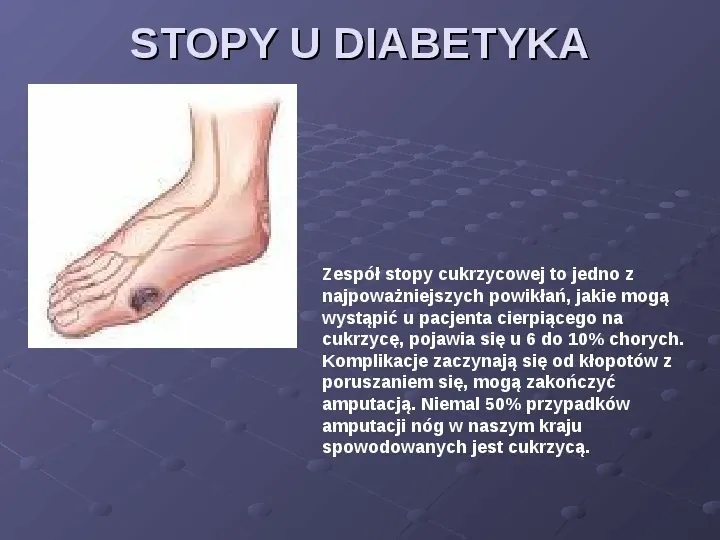 Cukrzyca - Slide 12