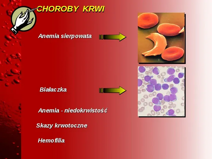 Skład i rola krwi - Slide 10