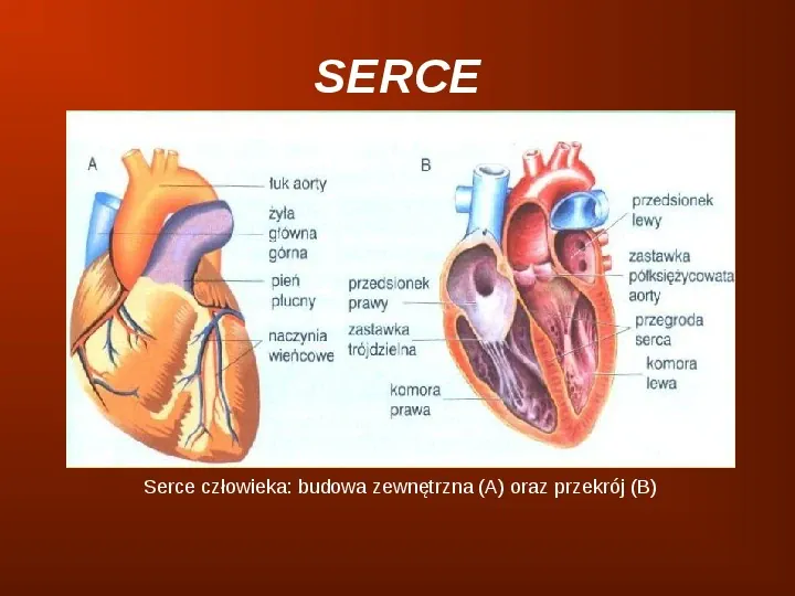 Choroby układu krwionośnego człowieka - Slide 3