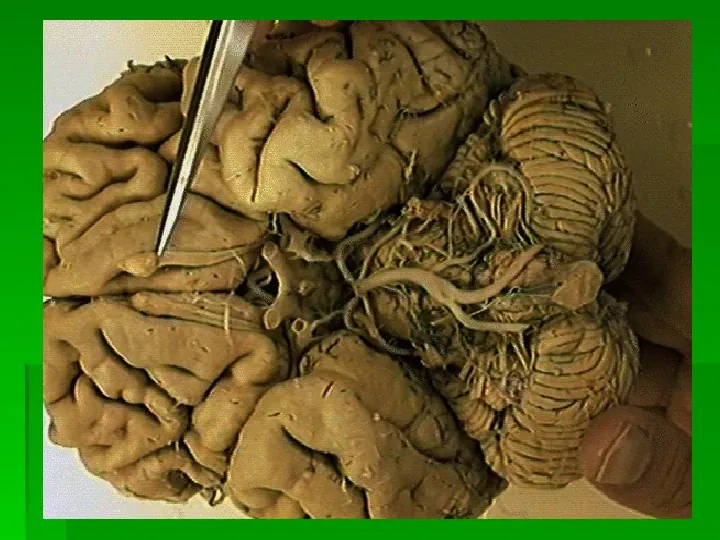 Nerwy narządów zmysłów - Slide 10