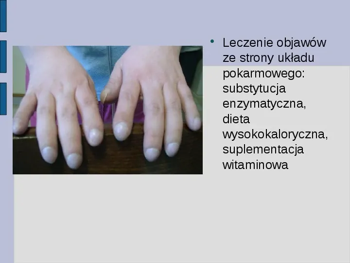 Choroby genetyczne człowieka - Slide 16