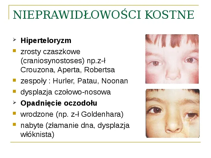 Objawy kliniczne w chorobach oczodołu - Slide 21