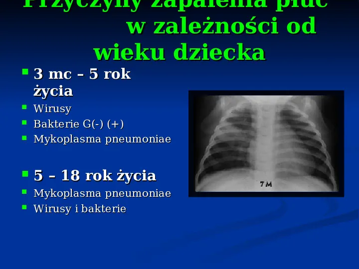 Ostre choroby układu oddechowego - Slide 27