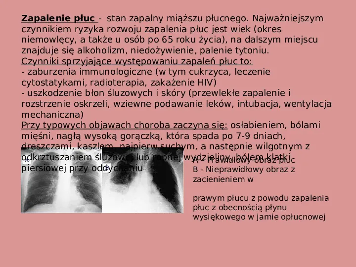 Choroby i higiena układu oddechowego - Slide 4
