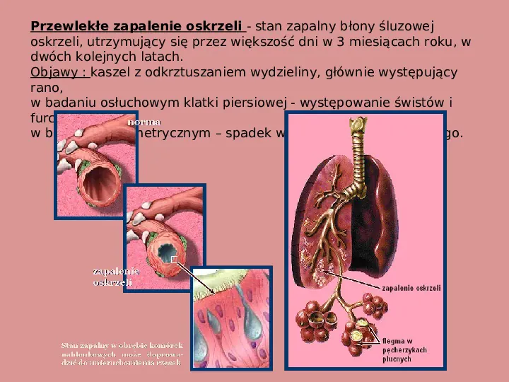 Choroby i higiena układu oddechowego - Slide 5