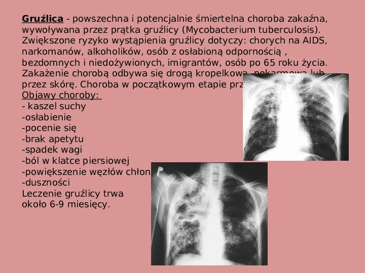 Choroby i higiena układu oddechowego - Slide 7