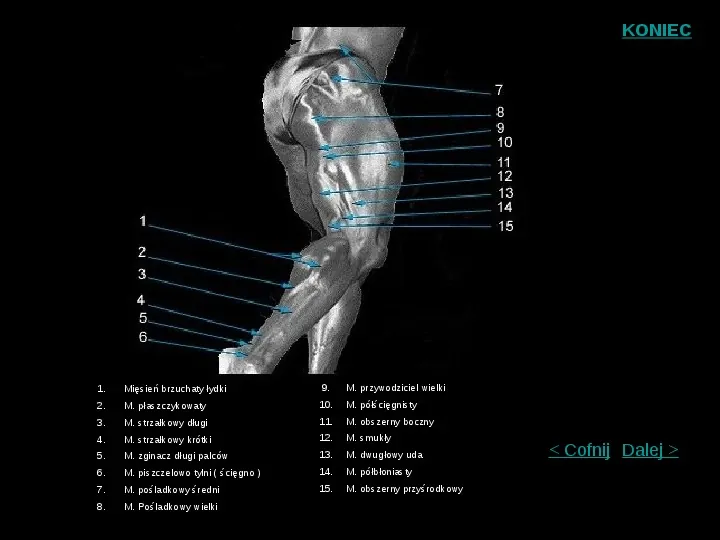 Mięśnie szkieletowe człowieka - Slide 7