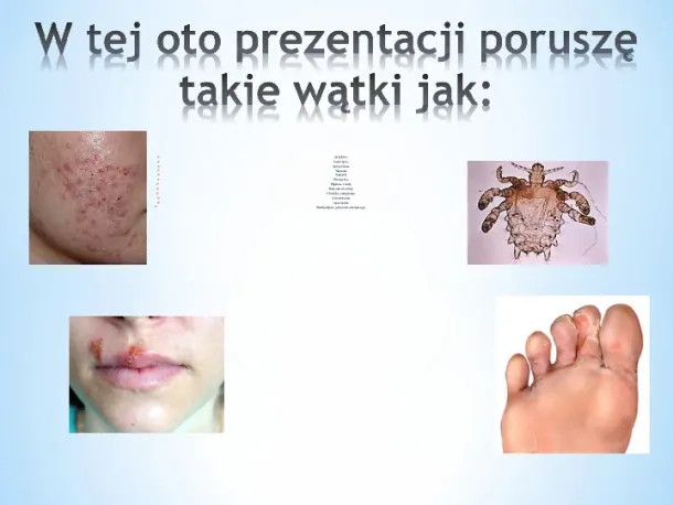 Choroby i higiena skóry - Slide pierwszy